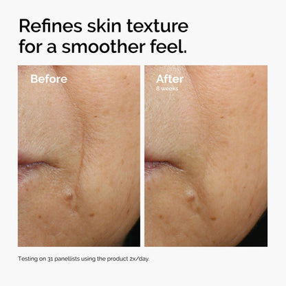 Caffeine 3% + Escin 1% Face Serum - US 3982