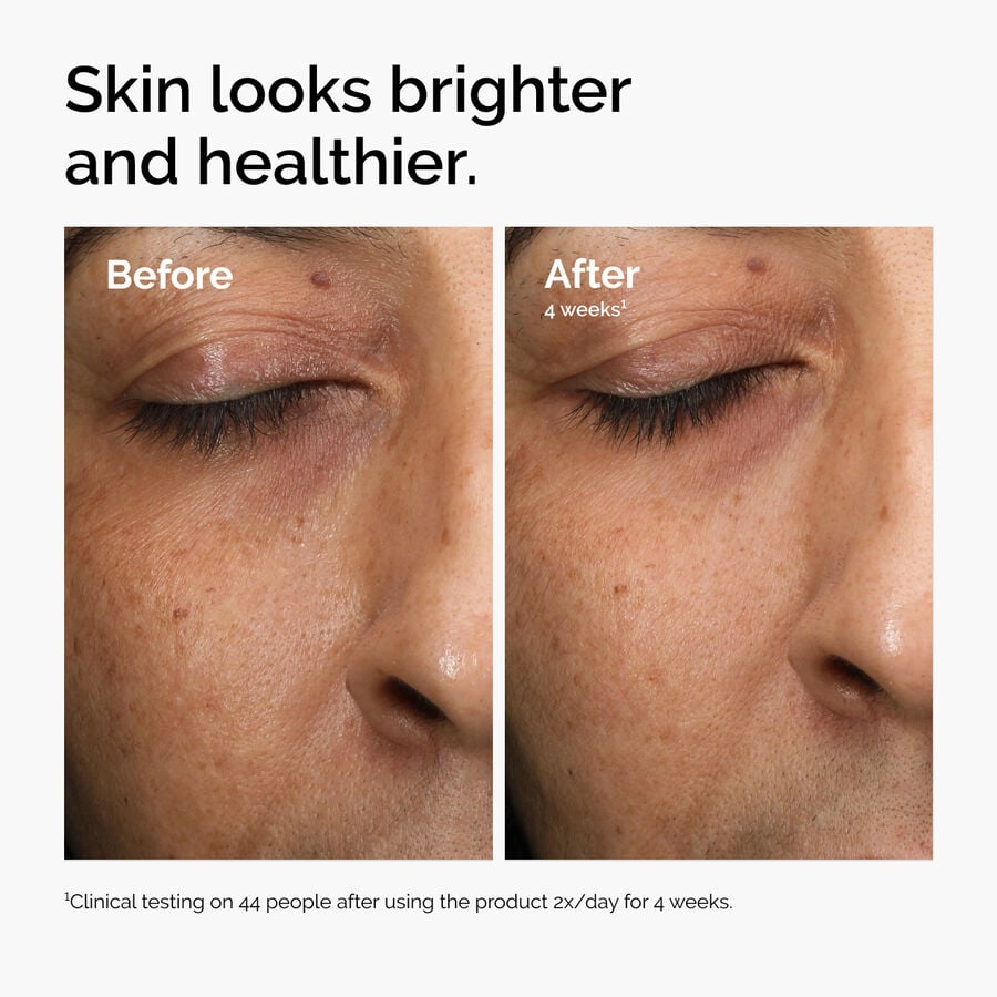 Multi-Antioxidant Radiance Serum - US 4874